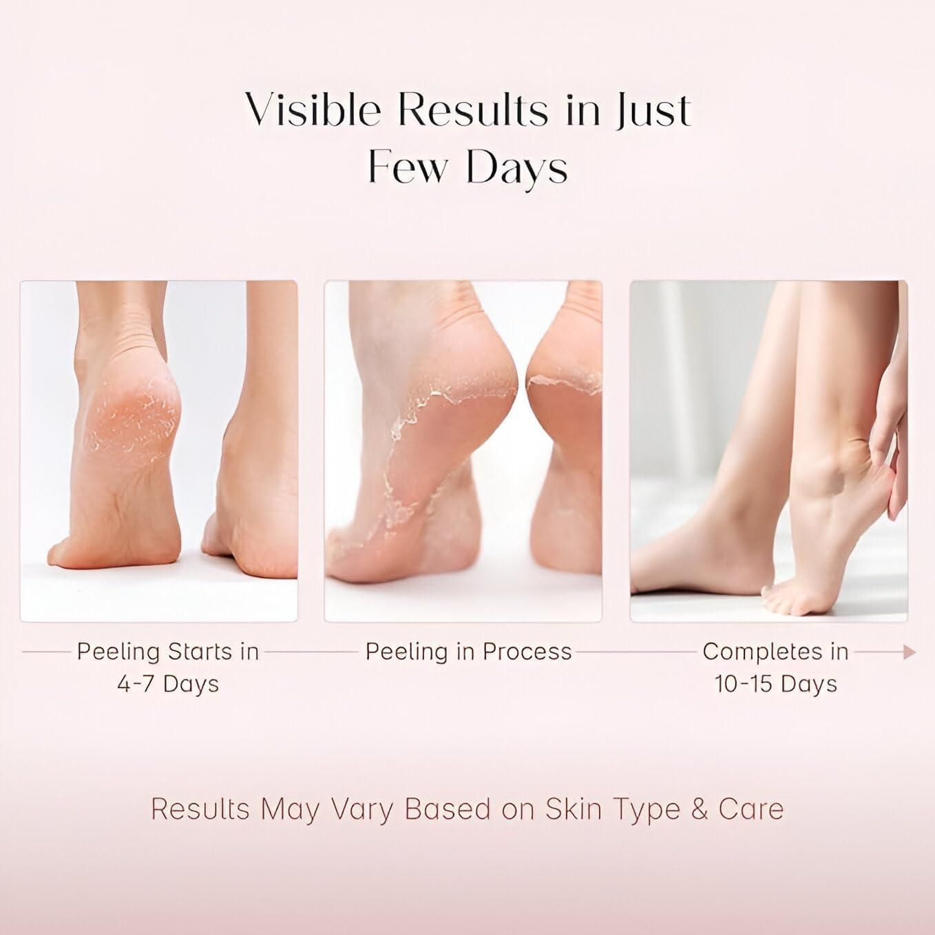 Foot Peeling Mask for Dead Skin Removal