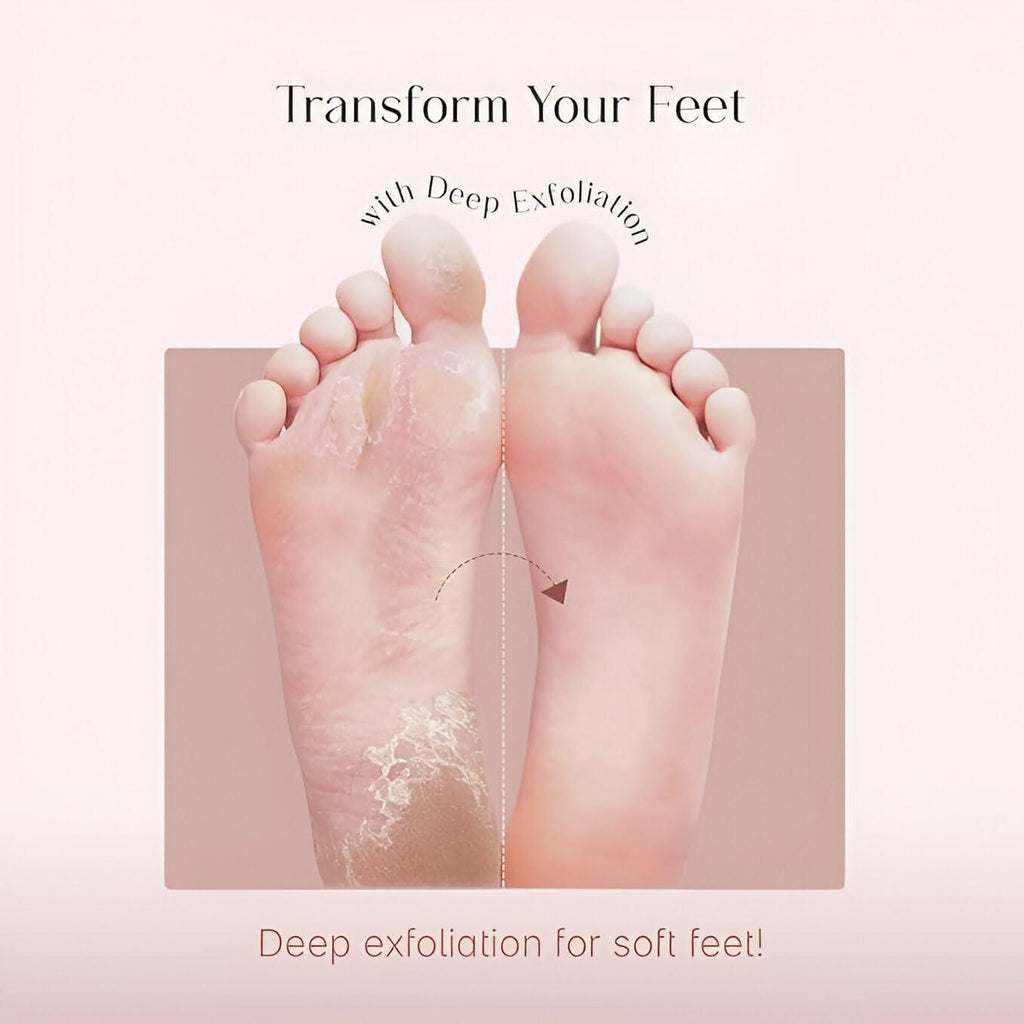 Foot Peeling Mask for Dead Skin Removal