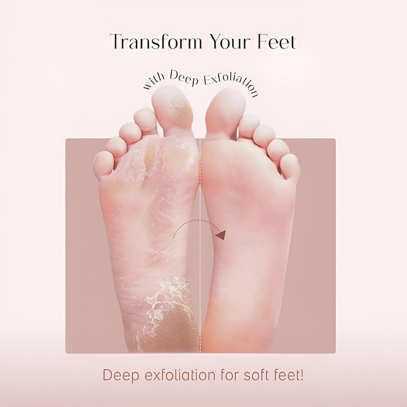 Foot Peeling Mask for Dead Skin Removal